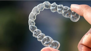 Things to consider before starting Invisalign Treatment - Things you don